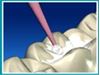 Picture of Microbrush Disposable Applicators 400/pk - Microbrush