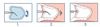 Picture of NeoDrys Absorbents - Cheek Protectors 50/pk - Microcopy