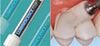 Picture of Luminescence Gel Syringe 3gm - Premier